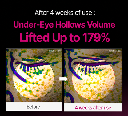 🔥LAST DAY 50% OFF!! Calcium Dark Spot Eye Cream